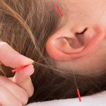 تأثیر طب سوزنی در درمان کم شنوایی