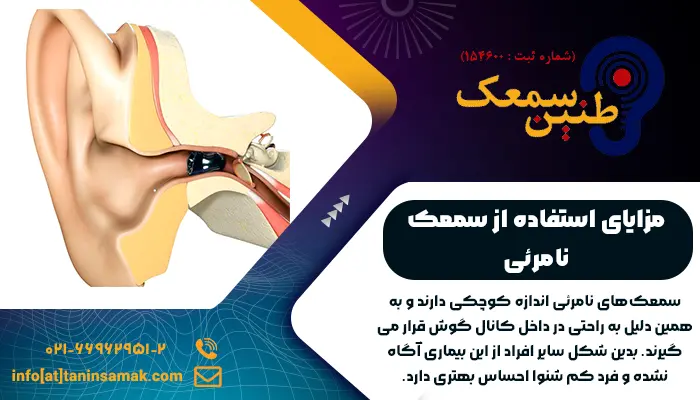 یکی از مزایای استفاده از سمعک نامرئی، اندازه کوچک آن و تناسب آن با کانال گوش است