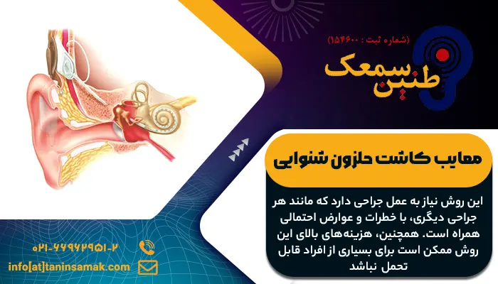 معایب کاشت حلزون برای درمان کم شنوایی